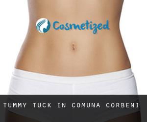 Tummy Tuck in Comuna Corbeni