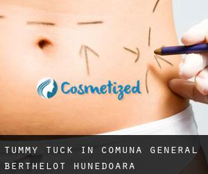 Tummy Tuck in Comuna General Berthelot (Hunedoara)