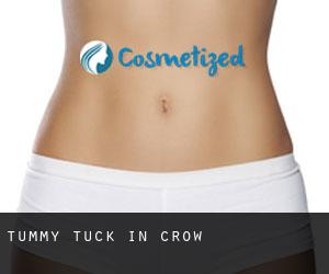 Tummy Tuck in Crow