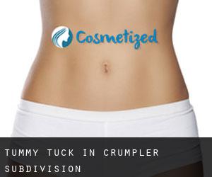 Tummy Tuck in Crumpler Subdivision