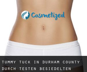 Tummy Tuck in Durham County durch testen besiedelten gebiet - Seite 1