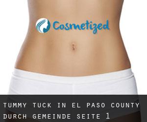Tummy Tuck in El Paso County durch gemeinde - Seite 1