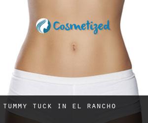 Tummy Tuck in El Rancho