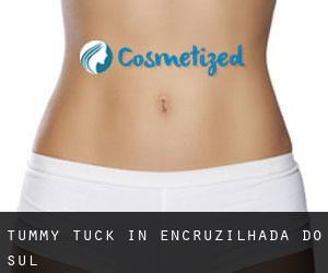 Tummy Tuck in Encruzilhada do Sul
