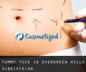 Tummy Tuck in Evergreen Hills Subdivision