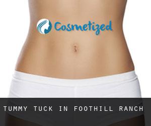 Tummy Tuck in Foothill Ranch