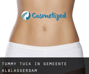 Tummy Tuck in Gemeente Alblasserdam