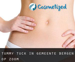 Tummy Tuck in Gemeente Bergen op Zoom