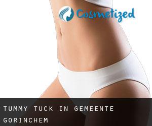 Tummy Tuck in Gemeente Gorinchem