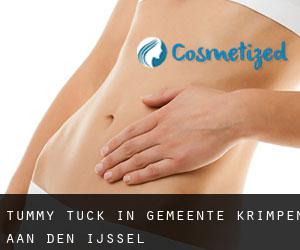 Tummy Tuck in Gemeente Krimpen aan den IJssel