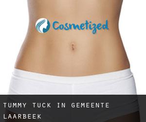 Tummy Tuck in Gemeente Laarbeek
