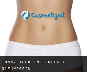 Tummy Tuck in Gemeente Nieuwegein