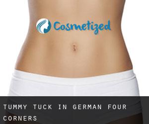 Tummy Tuck in German Four Corners
