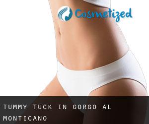 Tummy Tuck in Gorgo al Monticano