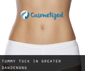 Tummy Tuck in Greater Dandenong