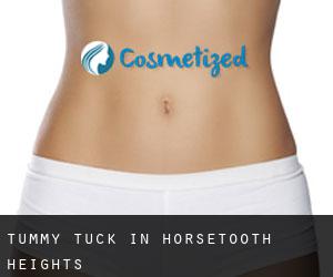 Tummy Tuck in Horsetooth Heights
