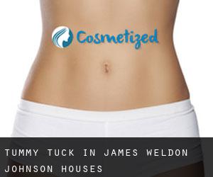 Tummy Tuck in James Weldon Johnson Houses
