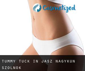 Tummy Tuck in Jász-Nagykun-Szolnok Tummy Tuck in Jász-Nagykun-Szolnok