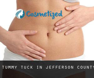 Tummy Tuck in Jefferson County