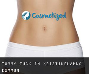 Tummy Tuck in Kristinehamns Kommun