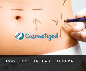 Tummy Tuck in Las Higueras