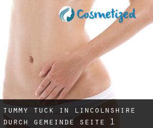 Tummy Tuck in Lincolnshire durch gemeinde - Seite 1