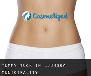 Tummy Tuck in Ljungby Municipality Tummy Tuck in Ljungby Municipality