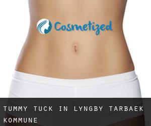 Tummy Tuck in Lyngby-Tårbæk Kommune