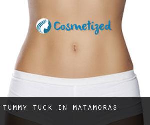 Tummy Tuck in Matamoras