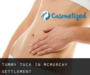 Tummy Tuck in McMurchy Settlement