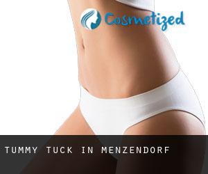 Tummy Tuck in Menzendorf