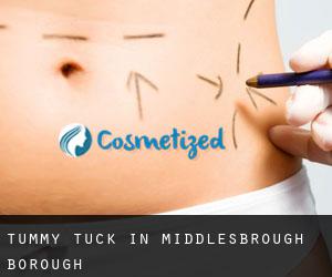Tummy Tuck in Middlesbrough (Borough)