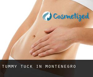 Tummy Tuck in Montenegro