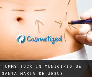 Tummy Tuck in Municipio de Santa María de Jesús