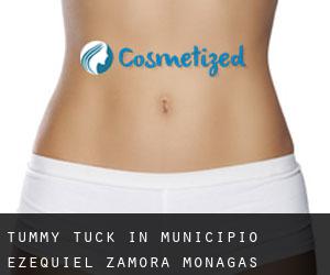 Tummy Tuck in Municipio Ezequiel Zamora (Monagas)