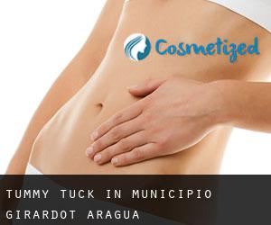 Tummy Tuck in Municipio Girardot (Aragua)