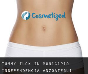 Tummy Tuck in Municipio Independencia (Anzoátegui)