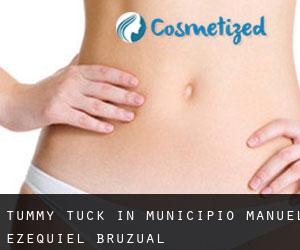 Tummy Tuck in Municipio Manuel Ezequiel Bruzual