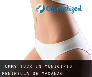 Tummy Tuck in Municipio Península de Macanao