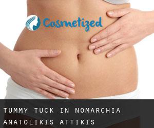 Tummy Tuck in Nomarchía Anatolikís Attikís