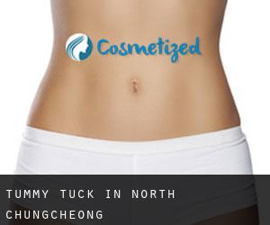 Tummy Tuck in North Chungcheong