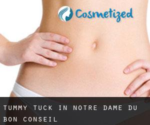 Tummy Tuck in Notre-Dame-du-Bon-Conseil