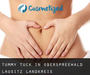 Tummy Tuck in Oberspreewald-Lausitz Landkreis