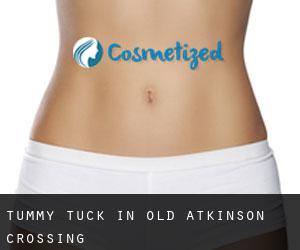Tummy Tuck in Old Atkinson Crossing