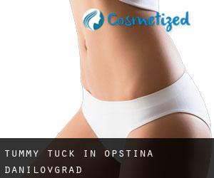 Tummy Tuck in Opština Danilovgrad Tummy Tuck in Opština Danilovgrad