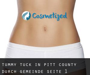 Tummy Tuck in Pitt County durch gemeinde - Seite 1