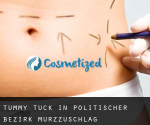 Tummy Tuck in Politischer Bezirk Mürzzuschlag
