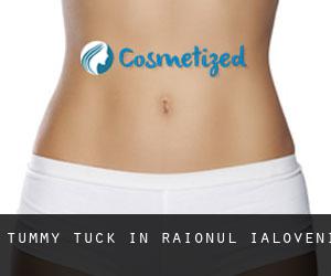 Tummy Tuck in Raionul Ialoveni