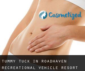 Tummy Tuck in Roadhaven Recreational Vehicle Resort