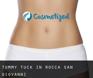 Tummy Tuck in Rocca San Giovanni